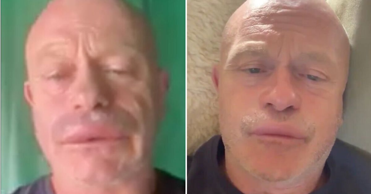 Ross Kemp Reveals Extreme Swollen Lip After Being Stung In Wasp Attack Huffpost Uk Entertainment