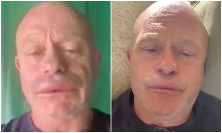 Ross Kemp went to hospital to receive treatment after being stung by wasps