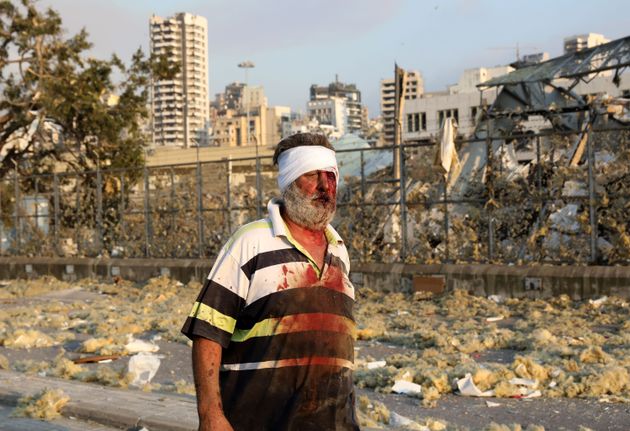 A wounded man walks near the scene of an explosion in Beirut.