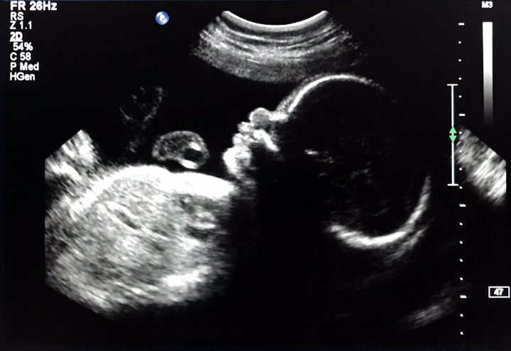 An ultrasound of the writer's son.