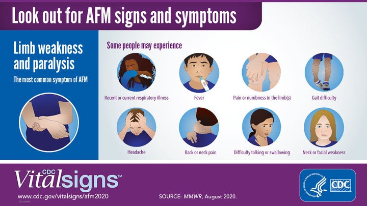 These are some of the signs and symptoms to watch out for. Acute flaccid myelitis, or AFM, generally causes fever and/or respiratory illness before limb weakness sets in.