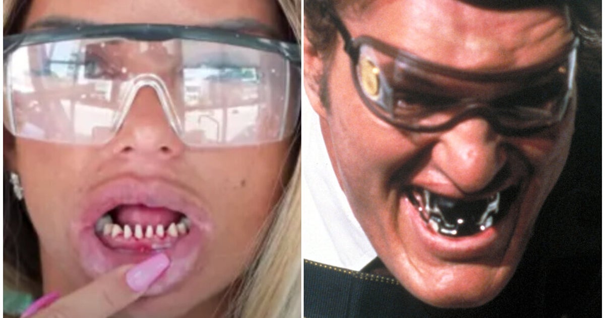 pix Katie Price Teeth Before katie price compares herself to james