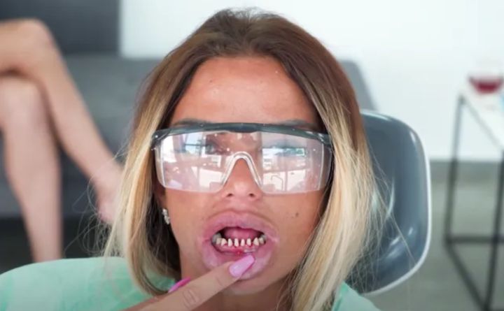 Katie Price shows off what's left of her real teeth.