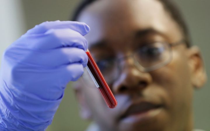 Leon McFarlane, a research technician, handles a blood sample in a laboratory at Imperial College in London, which is working on the development of a COVID-19 vaccine.