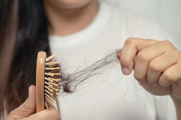 Even if you hair is falling out, it might not actually be considered "hair loss."