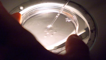 Spermatozoides