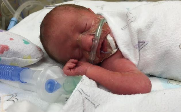 CA in the neonatal intensive care unit on Sept. 14, 2015, the day he was born.