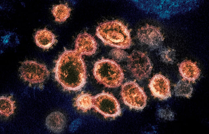 Evidence has shown that the coronavirus, pictured here under a microscope, can spread in the air through tiny respiratory droplets called aerosols, scientists say. These can be released when someone coughs, sneezes, sings or talks.