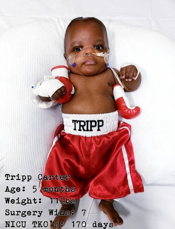 Baby Tripp spent Halloween 2019 in the neonatal intensive care unit. "Tripp has knocked out 7 brain surgeries and has beat 170 days in the NICU. Happy Halloween from our little fighter!�," wrote his mom, @themrscartershow, in a sweet Instagram post. 