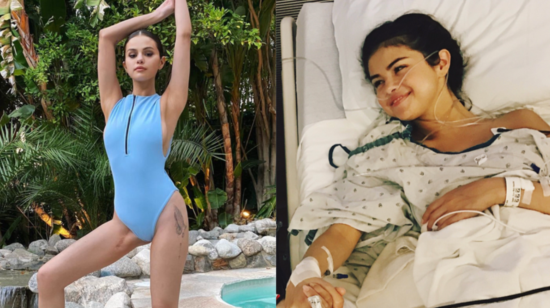 Selena Gomez Proudly Shows Off Kidney Transplant Scar After Covering Up For  Years