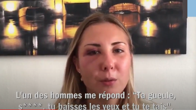 "Aggredita solo perché indossavo la gonna": la denuncia di una 22enne a Strasburgo "Aggredita solo perché indossavo la gonna": la denuncia di una 22enne a Strasburgo