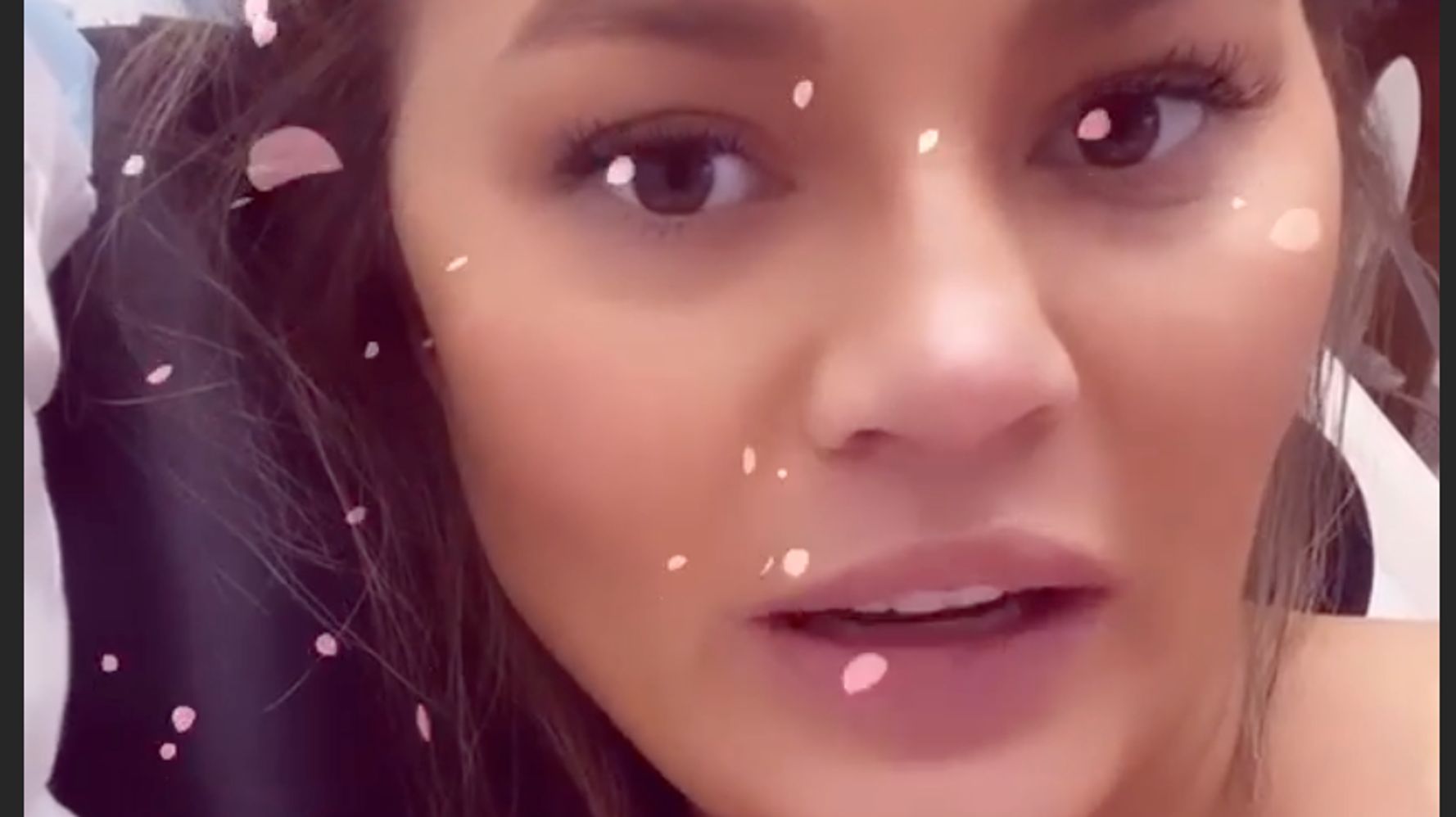 chrissy-teigen-explains-very-bad-pregnancy-bleeding-there-s-really