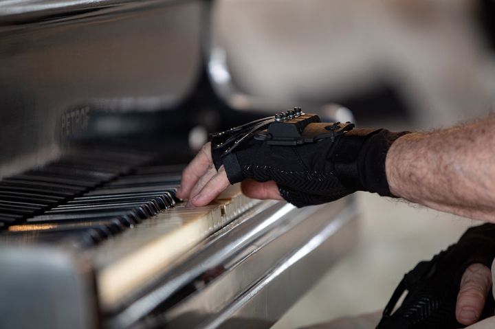 マルティンスさんが装着するバイオニック技術を使った手袋(AP Photo/Andre Penner)