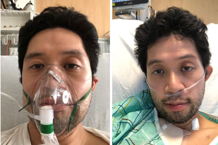 David Lat was hospitalized in March in New York City. He spent six days on a ventilator.