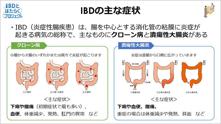 IBDの主な症状。佐賀大学医学部内科学講座消化器内科教授の江﨑幹宏医師が、IBDについて解説した。
