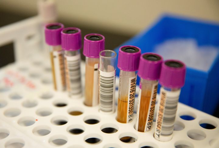 Convalescent plasma samples in vials are seen before being tested for COVID-19 antibodies at the Bloodworks Northwest Laboratory during the coronavirus disease (COVID-19) outbreak in Renton, Washington, U.S. September 9, 2020.