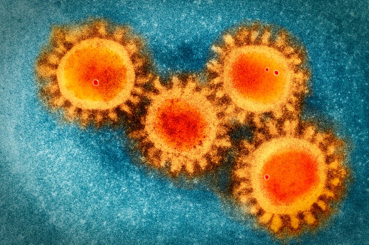 Imagen de microscopio de coronavirus. 