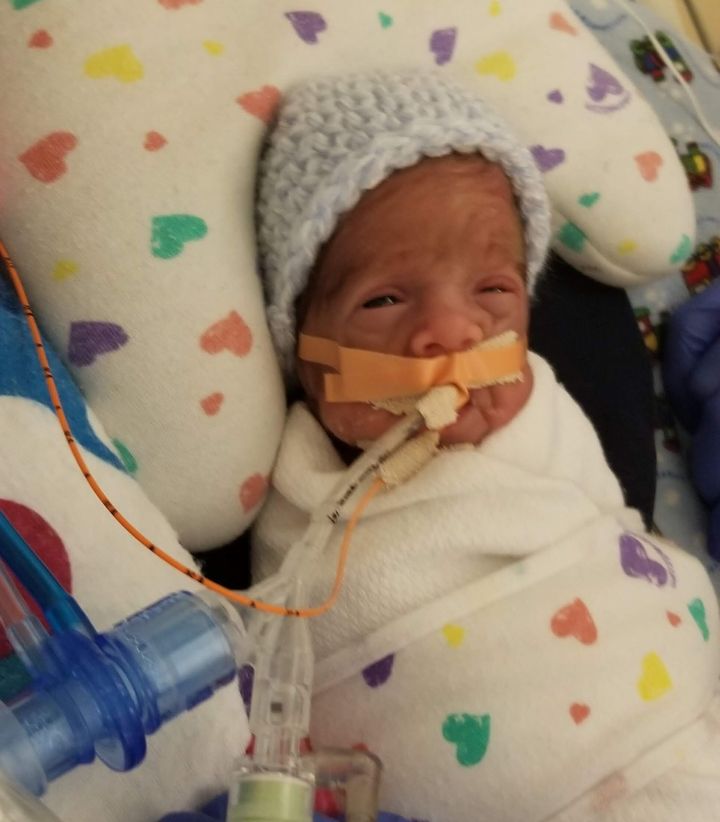 Ronan wasn't able to wear any clothes while he was alive, but his primary NICU nurse did manage to find a hat small enough to fit him. (Photo taken on May 21, 2020, at the Anschutz Medical Center near Denver.)