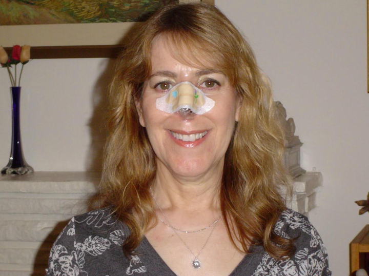 The author with her "temporary" fake nose.