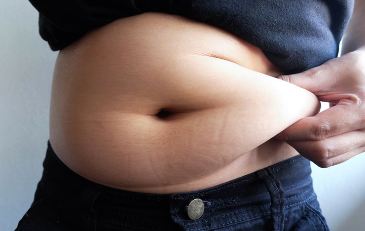A woman grabs her belly fat in this undated stock photo. A new survey suggests people who are more anxious about COVID-19 are more likely to be eating more during the pandemic.