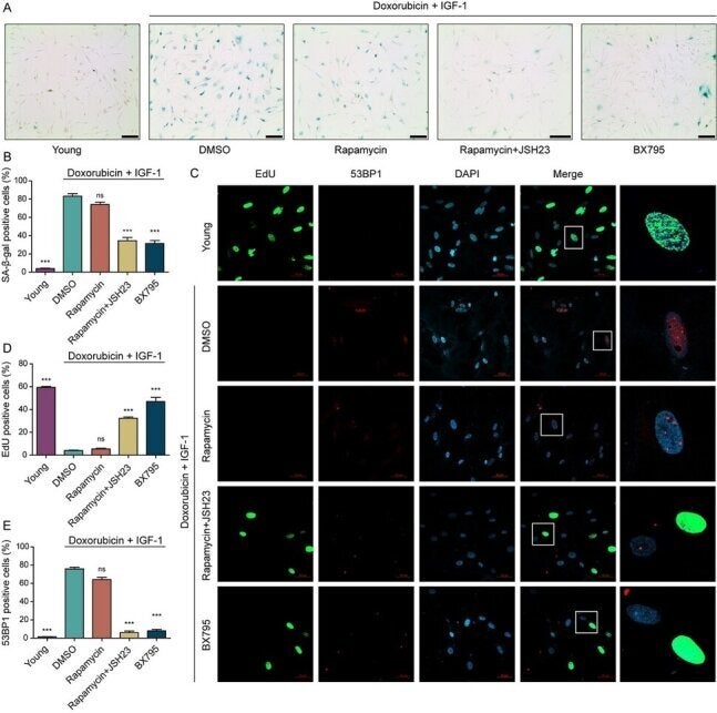 The research team of Professor Gwang-Hyun Cho from KAIST confirmed the 'rejuvenation effect' by inhibiting the expression of PDK1 and then verifying the markers of cellular aging of aged human dermal fibroblasts.