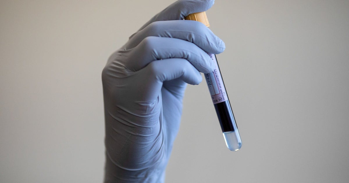 NHS To Trial Blood Test That Checks For 50 Types of Cancer HuffPost