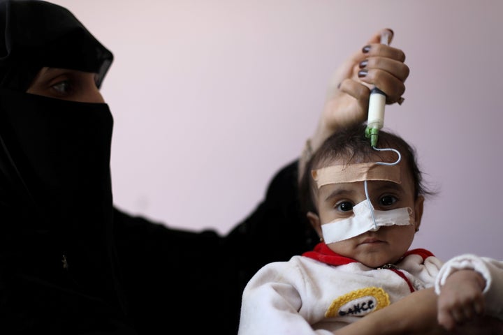 A malnourished child being fed in the Houthi-held city of Sanaa, Yemen, earlier this year.