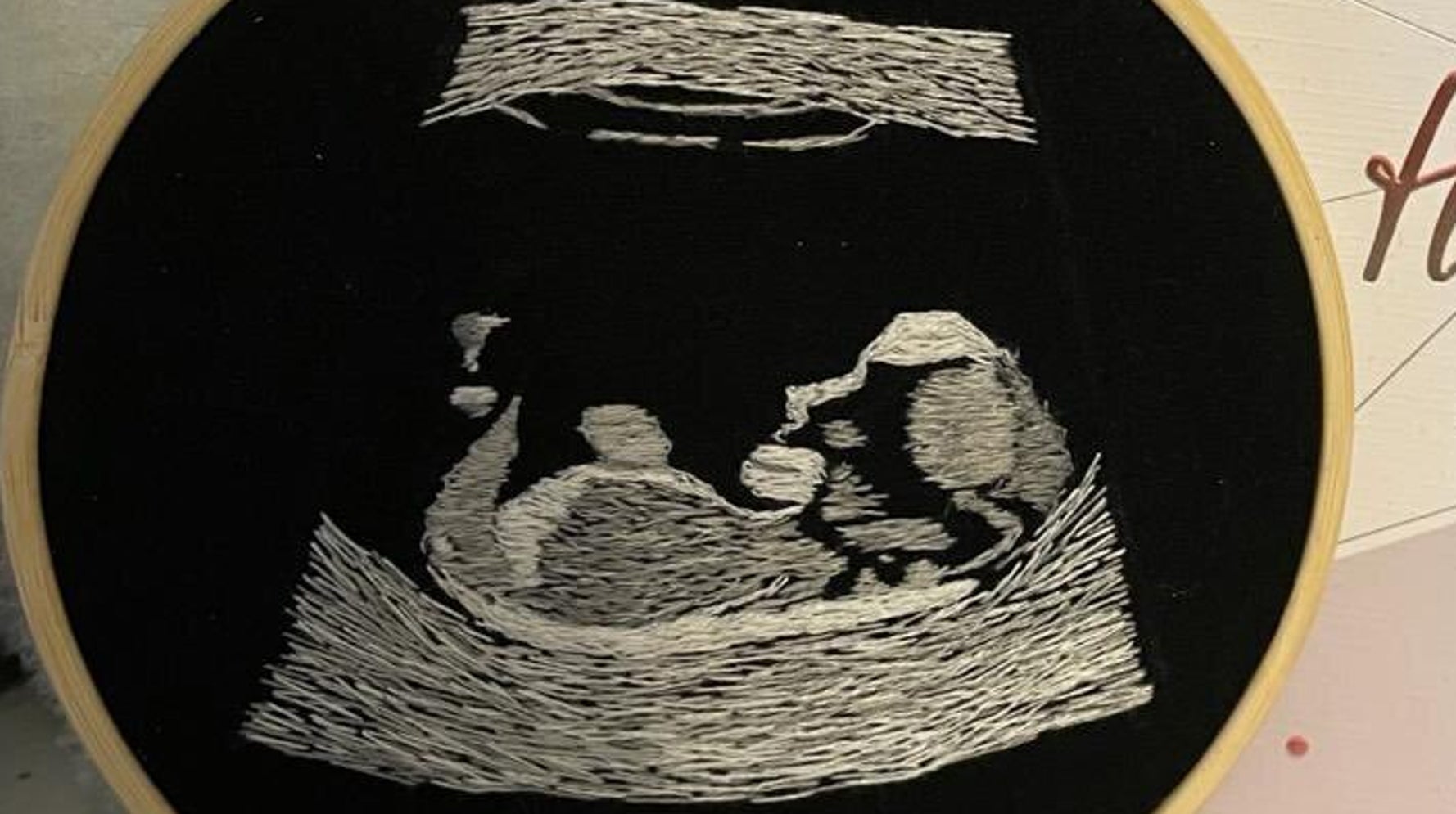 Blind DadToBe Gets ‘Incredible’ Tactile Ultrasound Scan HuffPost