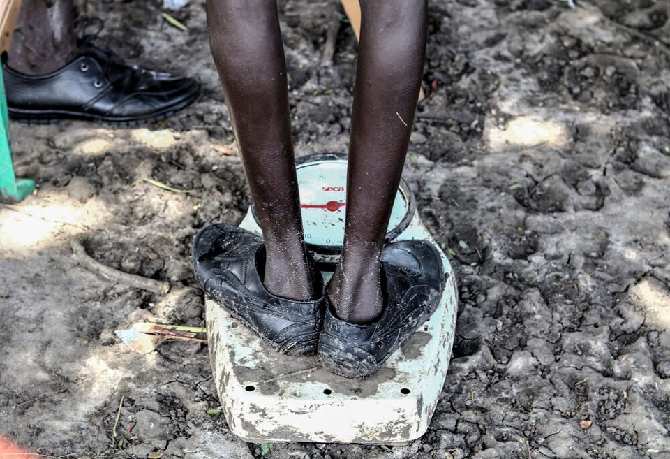 Μετά τις καταστροφικές πλημμύρες στο Νότιο Σουδάν, οι δρόμοι είναι αδιάβατοι. Οι Γιατροί Χωρίς Σύνορα με κινητές κλινικές προσπαθούν να προσεγγίσουν όσους έχουν ανάγκη. Εδώ ένα αγόρι μετρά το βάρος του στην κλινική των Γιατρών Χωρίς Σύνορα στην περιοχή Lanyeri payam.
