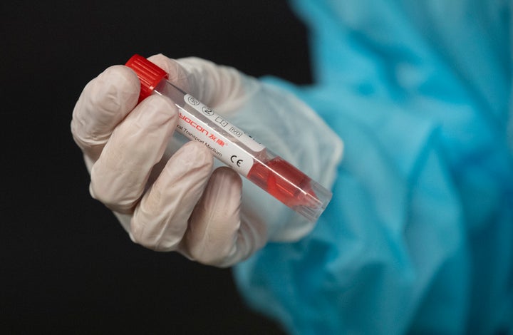 A nurse holds a vial containing a patients test swab on November 18, 2020 in Ottawa.