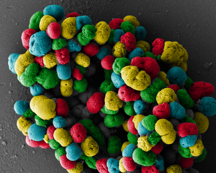 Bactéries de la famille des <em>Neisseriaceae</em> photographiées par microscopie électronique.