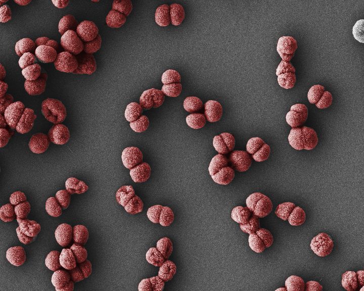 Photographie en microscopie électronique à balayage de la bactérie Neisseria gonorrhoeae.