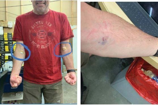 D'autres photos Facebook incluses dans le mandat de perquisition de Stine montrent des injections qui auraient été effectuées.