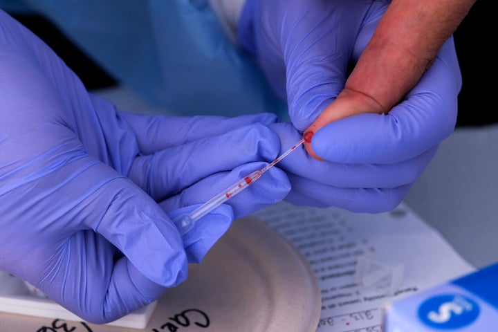 A healthcare worker draws blood from a person at the Southside Church of Christ in Los Angeles, California, on January 18, 2021 as free rapid Covid-19 antibody and PCR tests are administered to local residents in honor of Martin Luther King Jr. Day. (Photo by RINGO CHIU / AFP) (Photo by RINGO CHIU/AFP via Getty Images)