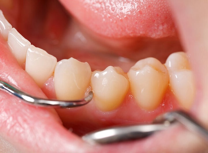 Tratamiento bucodental