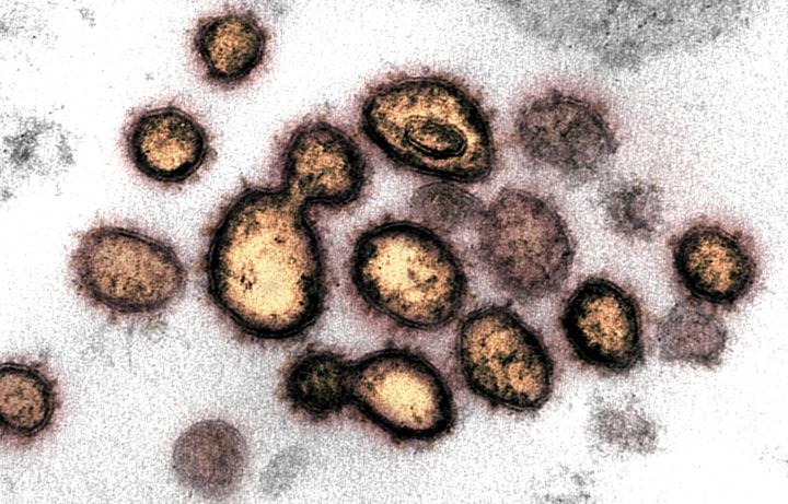 A microscope image shows SARS-CoV-2 isolated from an infected U.S. patient. COVID-19 has killed more than 2.2 million people worldwide, according to Johns Hopkins University.