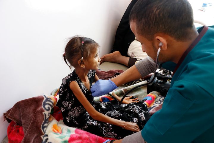 Ο πόλεμος στην Υεμένη και το εμπάργκο σε τρόφιμα έχει προκαλέσει λιμό. Θύματα ασιτίας τα παιδιά, που με ένα εξασθενημένο οργανισμό κινδυνεύουν περισσότερο να νοσήσουν βαριά και να πεθάνουν. 