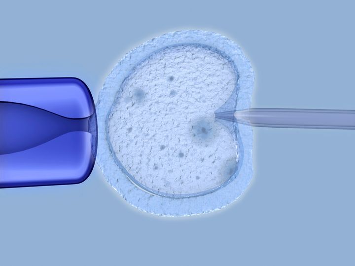 Invitro fertilisation being performed in a lab.