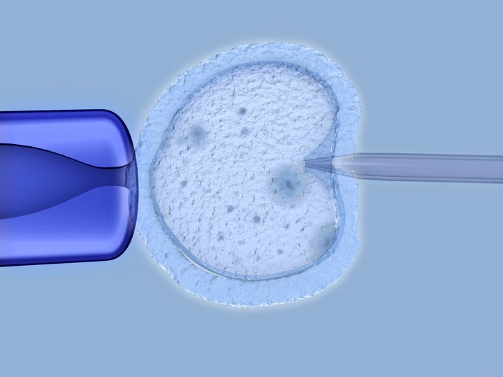 Invitro fertilisation being performed in a lab.