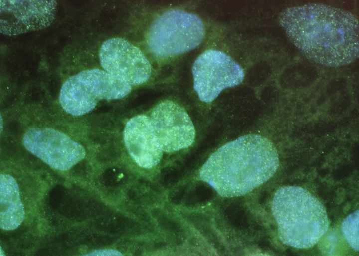 Stem cells on a computer screen at the University of Connecticut's Stem Cell Institute.