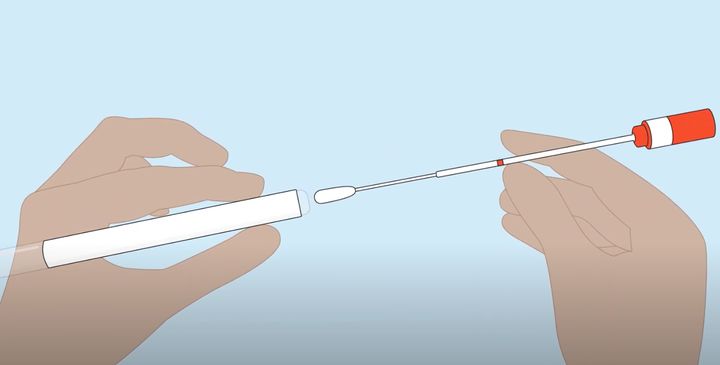 How To Check Yourself For Hpv