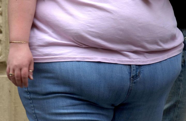 UK has globally high obesity rates
