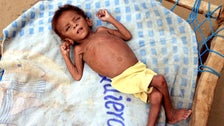 UN Envoy Paints Grim Picture Of Political, Economic And Humanitarian Crisis In Yemen UN Envoy Paints Grim Picture Of Political, Economic And Humanitarian Crisis In Yemen