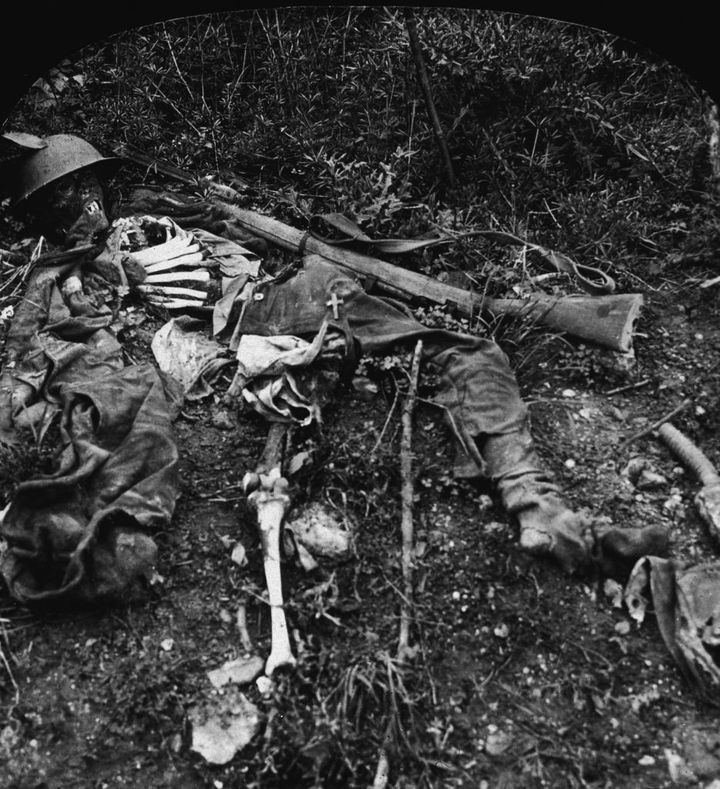 Τα οστά ενός στρατιώτη που έχασε την ζωή του σε μάχη του Πρώτου Παγκοσμίου Πολέμου, στο Chemin des Dames, στην Γαλλία, μέσα του 1910.