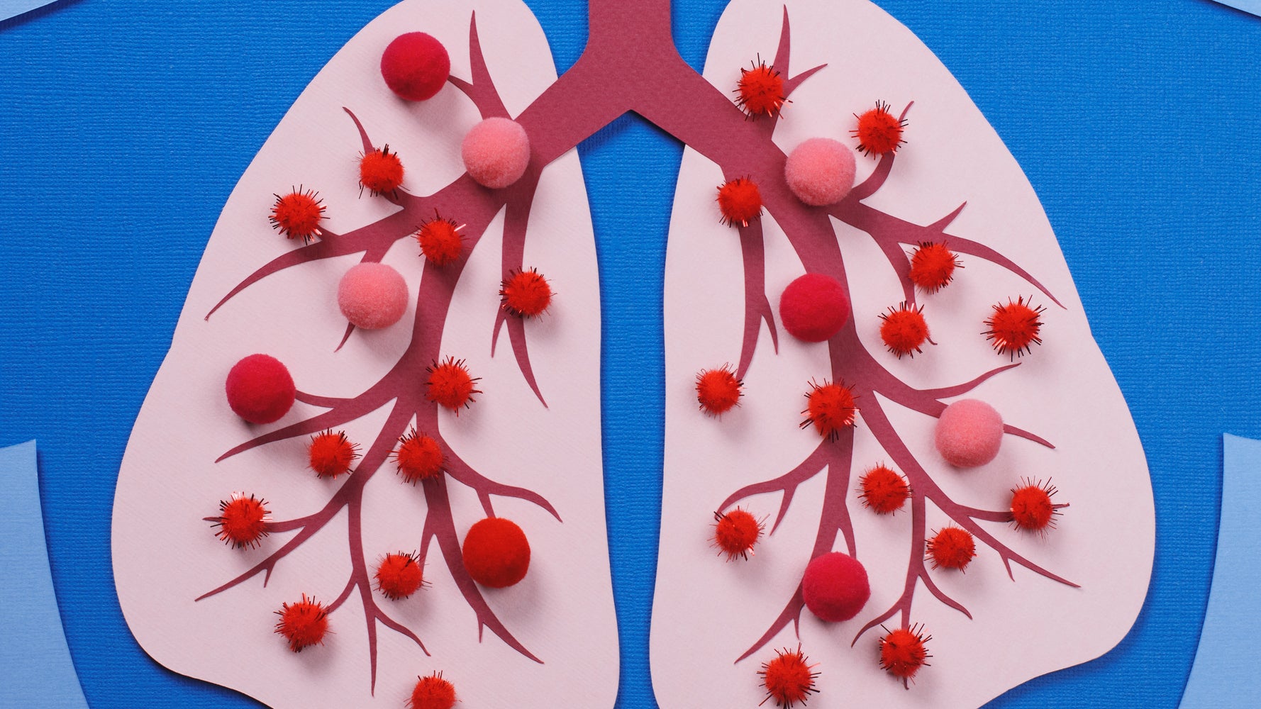 Lung Cancer Is ‘Being Missed’. Here’s How To Spot The Signs