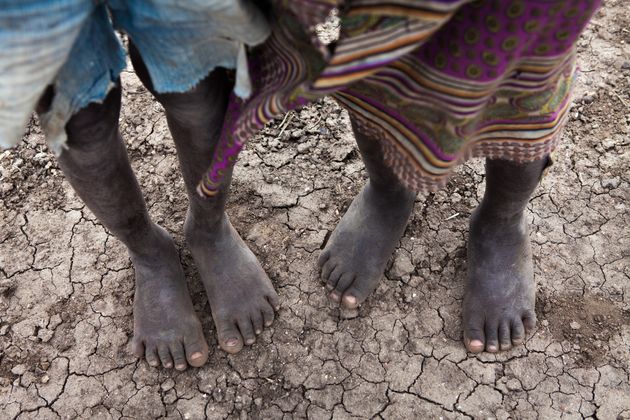 In Africa, dove covid e clima stanno devastando un miliardo di persone