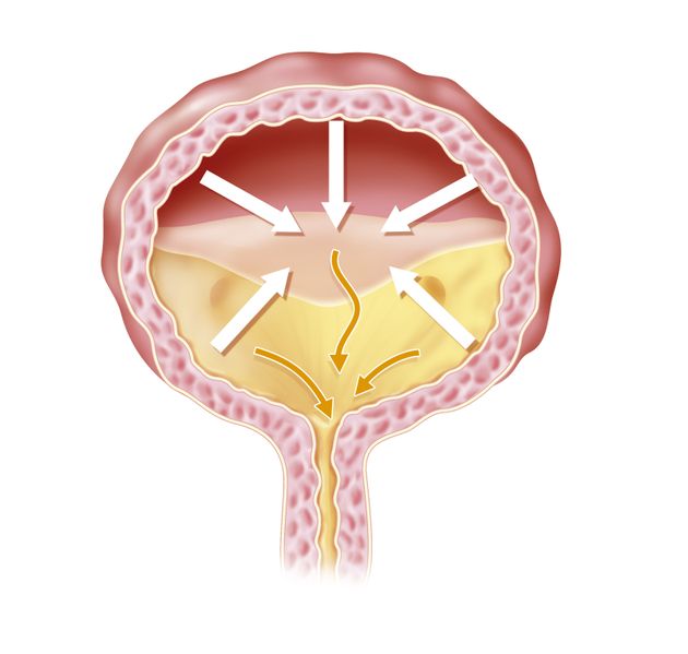 The detrusor muscle, seen here in the bladder's wall, contracts when it's time to urinate.