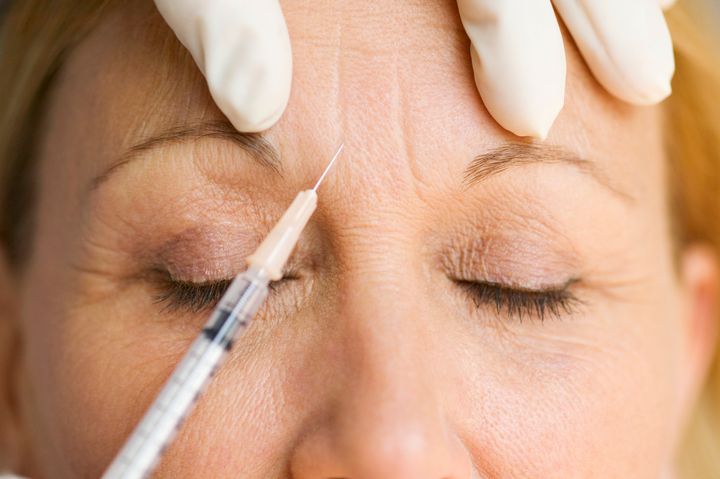 What Experts Say You Should Know About Getting Botox For The First Time |  HuffPost Life