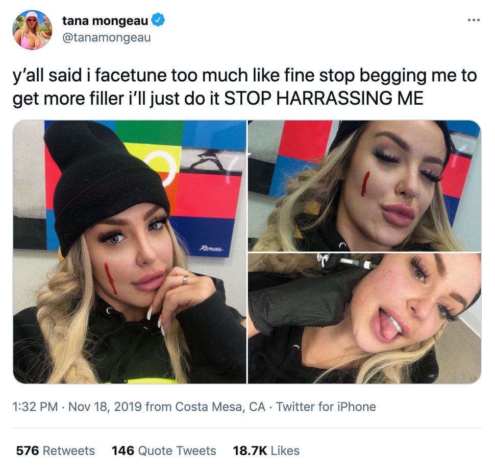 Influencer Tana Mongeau, 22, is open about her cosmetic procedures and use of Facetune.