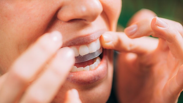 Teeth Whitening Kits Could Be Damaging Your Gnashers And Gums